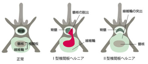 tsuikanban003